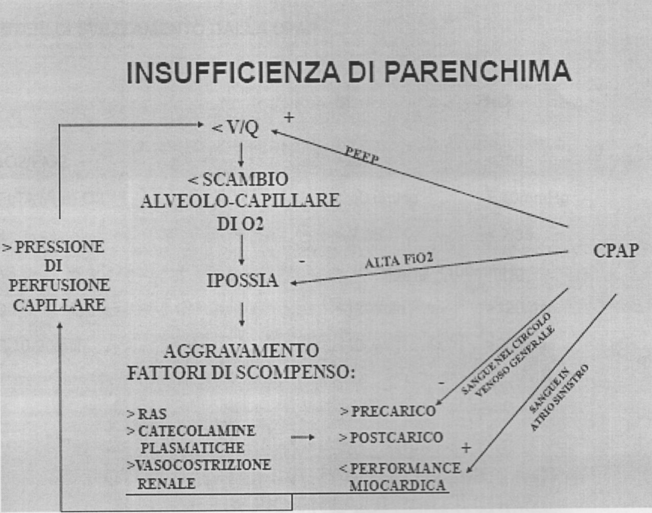 Schema di insufficienza di parenchima ventilazione meccanica non invasiva