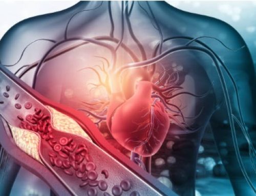 Colesterolo LDL-C: obiettivi di trattamento, calcolo del rischio cardiovascolare