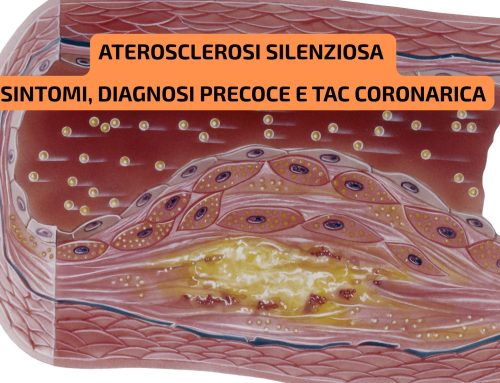 Aterosclerosi silenziosa: sintomi, diagnosi precoce e TAC coronarica